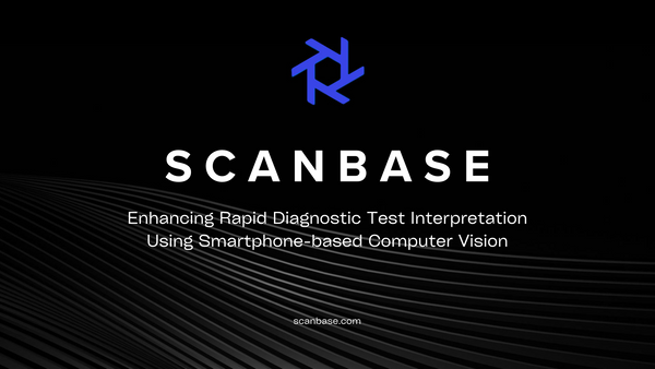 Enhancing Rapid Diagnostic Test Interpretation Using Smartphone-based Computer Vision