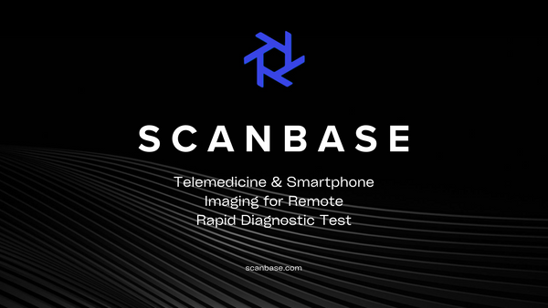 Telemedicine & Smartphone Imaging for Remote Rapid Diagnostic Test