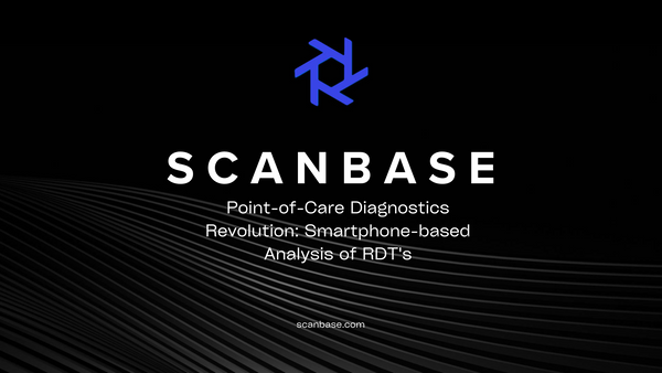 Point-of-Care Diagnostics Revolution: Smartphone-based Analysis of RDT's