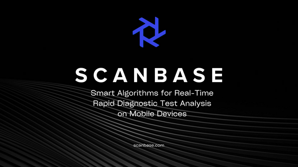 Smart Algorithms for Real-Time Rapid Diagnostic Test Analysis on Mobile Devices