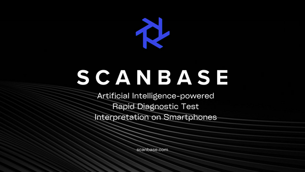 Artificial Intelligence-powered Rapid Diagnostic Test Interpretation on Smartphones