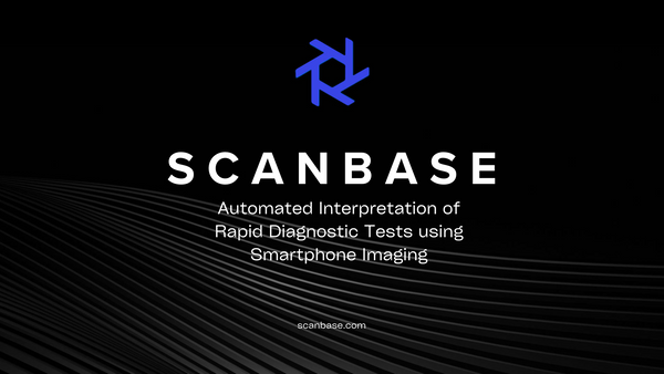 Automated Interpretation of Rapid Diagnostic Tests using Smartphone Imaging