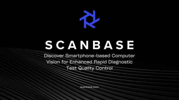 Discover Smartphone-based Computer Vision for Enhanced Rapid Diagnostic Test Quality Control