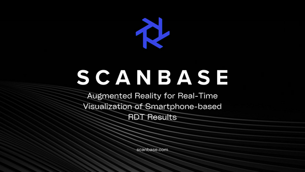 Augmented Reality for Real-Time Visualization of Smartphone-based RDT Results